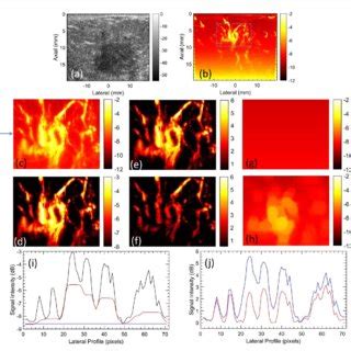 Representative image of breast tumor microvasculature, visualized with... | Download Scientific ...