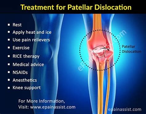 Pin on Sports Injuries