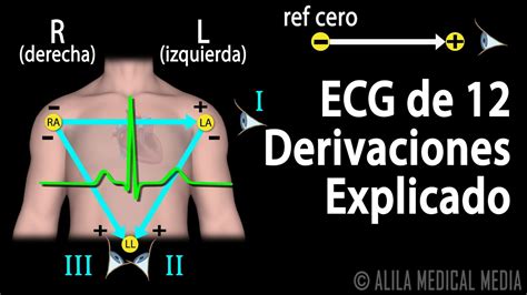 Ecg De Derivaciones Explicado Animaci N Alila Medical Media