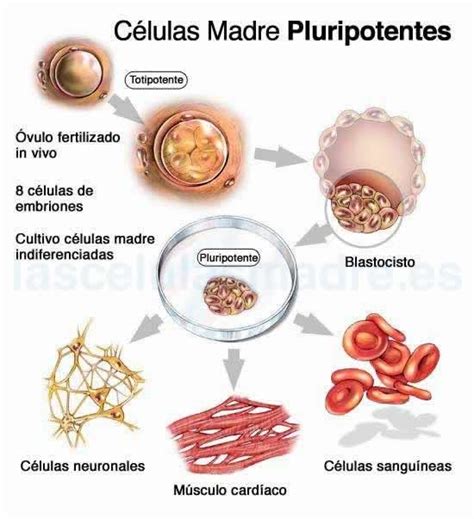 Células Madres Pluripotentes El futuro para la Retinosis Por Una