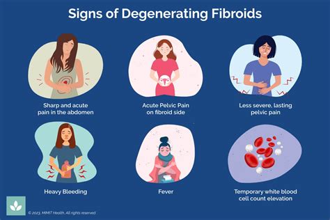 Fibroid Degeneration - MIMIT Health