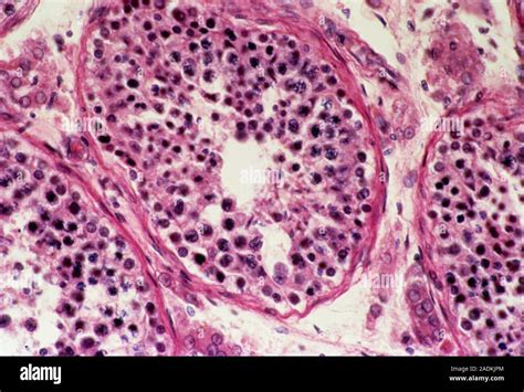 Light Micrograph Of A Section Through A Human Testis Showing Numerous