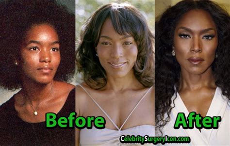 Angela Bassett Plastic Surgery Admits Botox Serum Injections