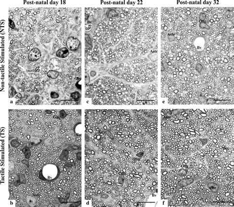 Representative Photomicrographs Of Cross Sections Of Rat Optic Nerves