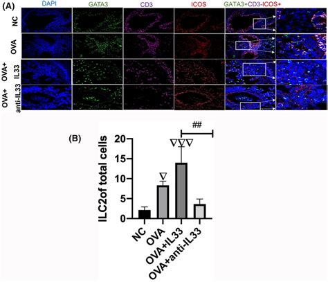 Il‐33 Increased Innate Lymphoid Cell Ilc2 Cell Accumulation Around