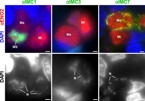 Imc Proteins In Gametocytes Ifa Of Toxoplasma Gametocyte Stages Where Download Scientific