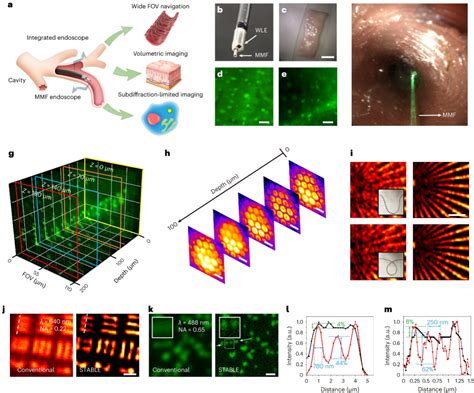 光电学院刘旭杨青研究团队在Nature Photonics发文报道超细内窥镜动态超分辨成像