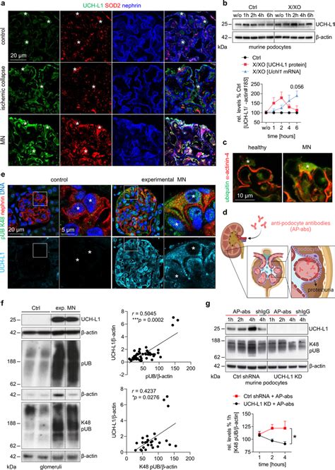 Oxidative Stress Leads To Uch L Upregulation Which Induces Ubiquitin