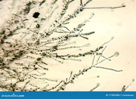 Dermatophyte Fungus Under The Microscope Stock Image | CartoonDealer ...