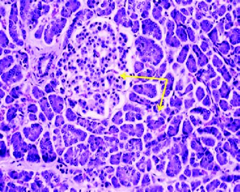 Photomicrograph Of Transverse Section Of Pancreas From Control Rat