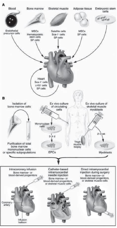 Sources Of Cells For Cardiac Stem Cell Therapy A And Routes Of Their