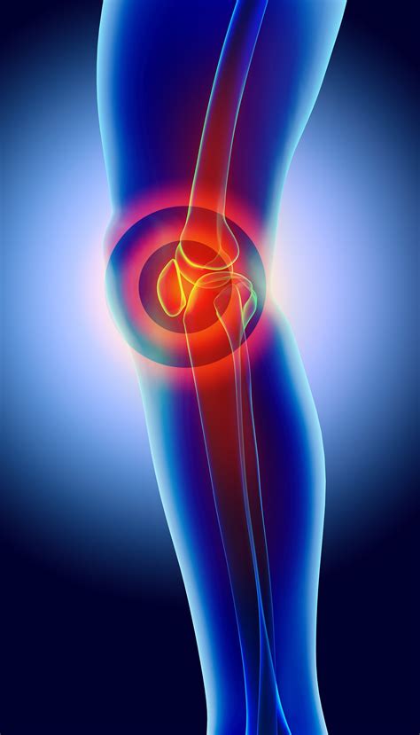 Seeking Knee Pain Relief In Nj Knee Pain Specialists And Treatments