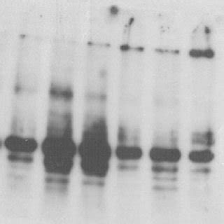 Immunological Detection Of Protein Carbonyl Groups In L Minor