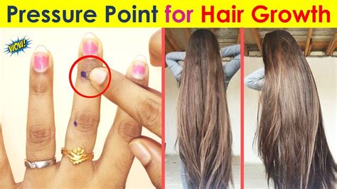 Sujok For Hair Growth Grow Hair Fast With Acupressure Point Youtube