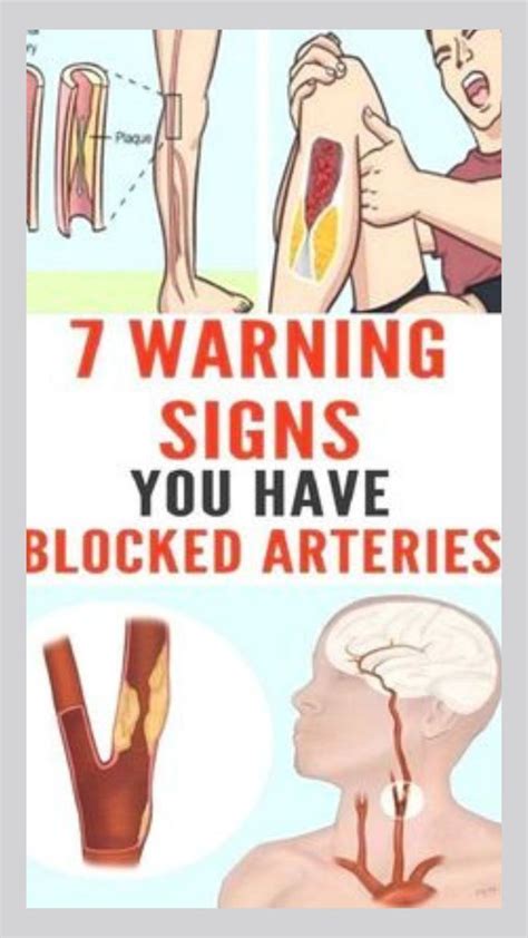 Here Are 7 Warning Signs You Have Blocked Arteries Artofit