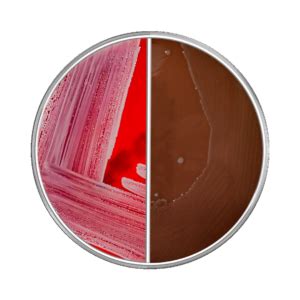 AGAR BIPLACA CNA CHOCOLATE MDM CAJA 90MM X 15MM MDM Científica