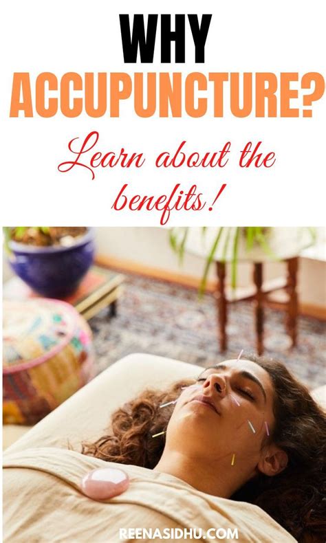 Benefits of acupuncture – Artofit