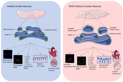 Summary Of Major Functions Of Reep In Cardiac Myocytes Reep Is A