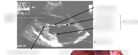 Diagramme De RCVR Anat Coeur Echographie Quizlet