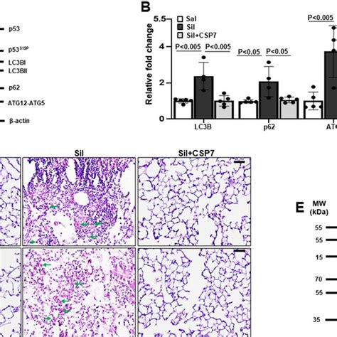 Abrogation Of Aberrant Autophagy By Csp In Mice With Silica Induced