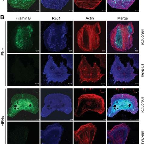 Filamin B Colocalizes With Rac1 In Membrane Ruffles A HeLa Cells