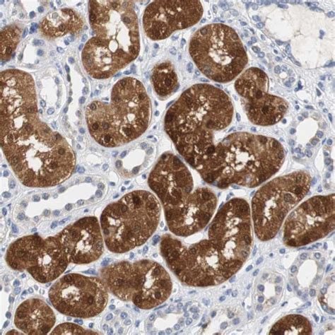 Rabbit Polyclonal Anti Pck1 Antibody Buy For Research Highly Specific Rigorously Validated