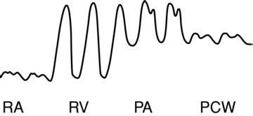 Ccrn Hemodynamics Flashcards Quizlet