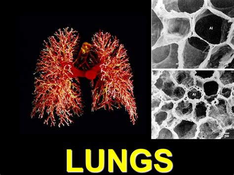 Ch15 Lungppt Based On Obstructive Lung Disease Ppt