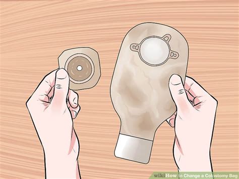 How To Change A Colostomy Bag Steps With Pictures Wikihow