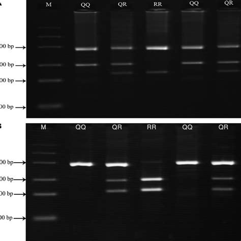 Results Of Tetra Arms Pcr A And Pcr Rflp B Of Pon1 Q192r Download Scientific Diagram