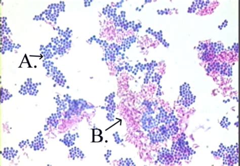 Exercise Acid Fast Endospore And Capsule Staining Techniques