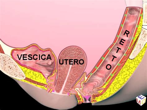 Chirurgia Prolasso Utero Vescica E Retto Tecnica Pops