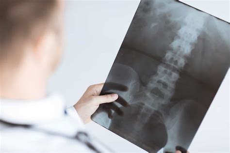 Spine Misalignment Learn The Symptoms And Treatment Options