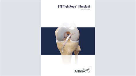 Arthrex Tightrope Ii Btb Implant