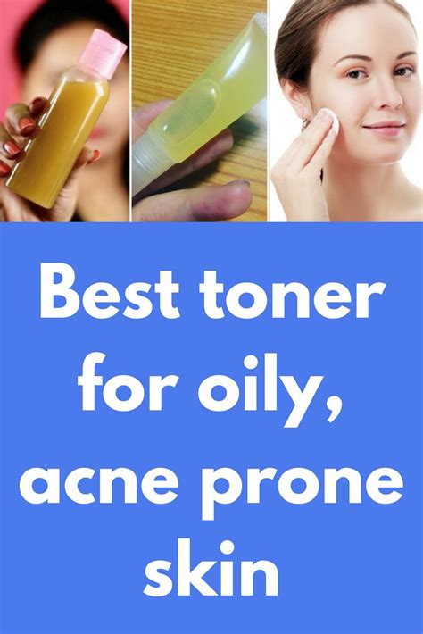 Best Toner For Oily Acne Prone Skin Today I Will Share How To Get