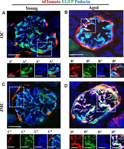 A Subset Of Newly Generated Podocytes Tdtomato Egfp From Pec