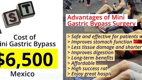 Best Mini Gastric Bypass Surgery In Piedras Negras Mexico