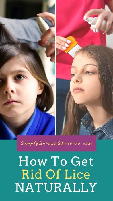 How To Get Rid Of Lice Naturally In One Day Simply Soraya Skincare