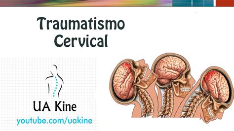 Traumatismo Medular Cervical YouTube