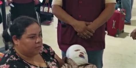 Niño de El Walamo sufre severas quemaduras en la cara con agua