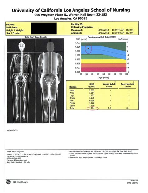 My Dexa Scan For Body Composition The Bjj Caveman