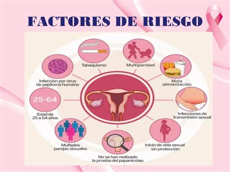 ¿qué Es El Cáncer De Cérvix Síntomas De Este Tumor Todo En La Red