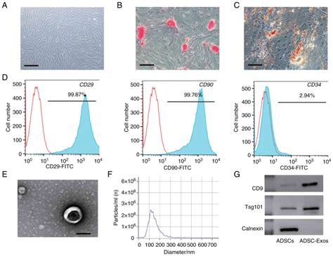 Lowintensity Pulsed Ultrasound Accelerates Diabetic Wound Healing By