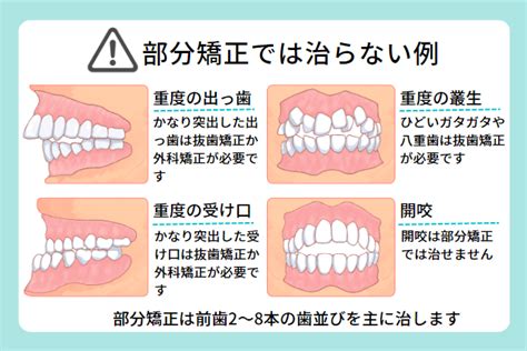 前歯がねじれている場合は部分矯正で治る？｜医療法人真摯会 大阪矯正歯科グループ