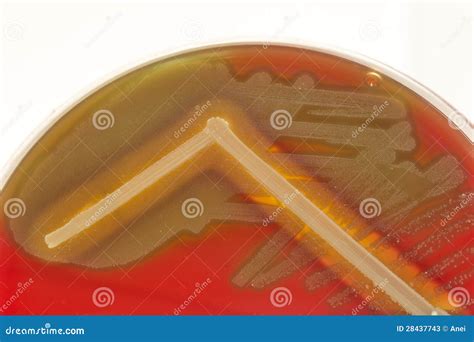 Diagnostic Bacterial Culture On Red Agar Stock Image Image Of