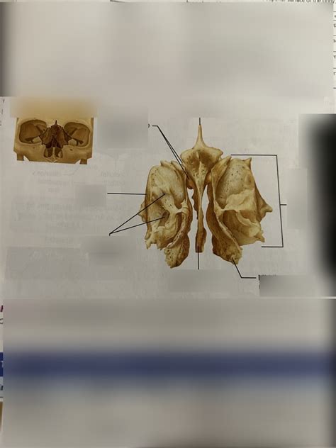 The Ethmoid Bone Diagram Quizlet