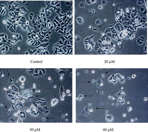 Induction Of Cell Cycle Arrest And Apoptosis By Copper Complex Cu Sbcm