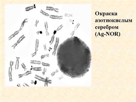 ХРОМОСОМЫ ЧЕЛОВЕКА I Развитие представлений о хромосомах