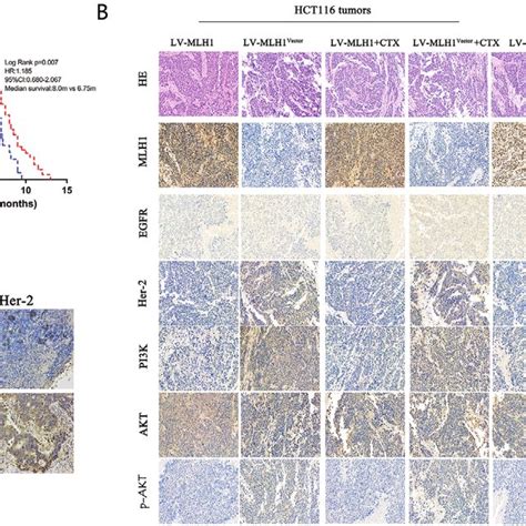 Signaling Pathways Involved In The Mlh1 Mediated Cetuximab Resistance