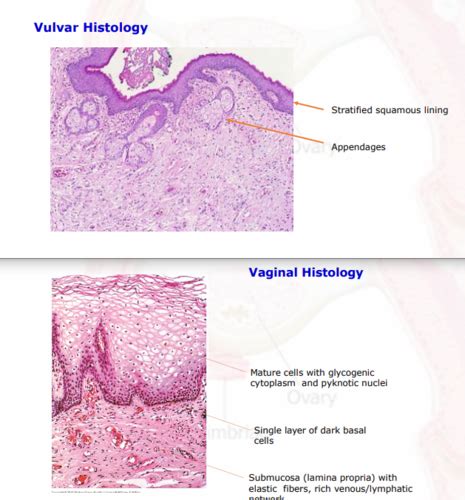 Disorders Of Vulva Vagina Cervix Flashcards Quizlet